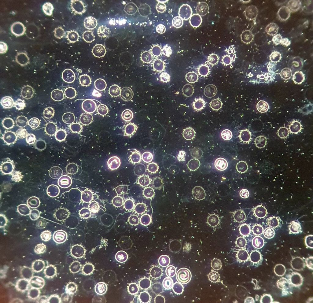 beschreibendes Bild für dunkelfeldmikroscopie von doris huber